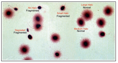 Sperms under microscope showing fragmented (small/no halos) and normal spermatozoa (large/medium halos)