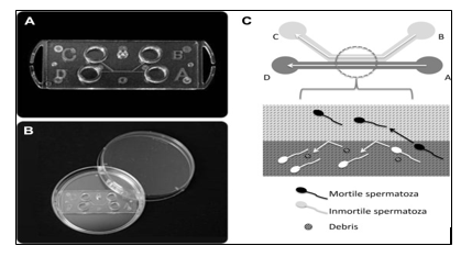 Microfluidic Sperm Sorter technology